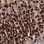 RRP36 Polyclonal Antibody