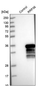 RRP36 Antibody in Western Blot (WB)