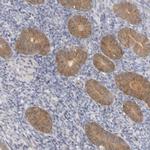 GGCT Polyclonal Antibody