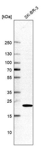 GGCT Antibody in Western Blot (WB)