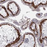 PEG10 Antibody in Immunohistochemistry (Paraffin) (IHC (P))