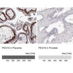 PEG10 Antibody in Immunohistochemistry (IHC)