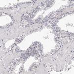 PEG10 Antibody in Immunohistochemistry (IHC)