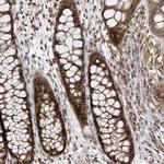C1orf131 Antibody in Immunohistochemistry (Paraffin) (IHC (P))