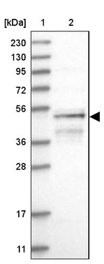 RUSC1 Antibody in Western Blot (WB)