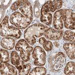 RUSC1 Antibody in Immunohistochemistry (Paraffin) (IHC (P))
