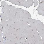 COA7 Antibody in Immunohistochemistry (IHC)