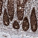 COA7 Antibody in Immunohistochemistry (IHC)