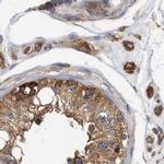 eIF3i Antibody in Immunohistochemistry (IHC)