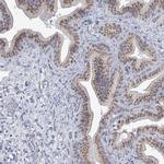 C21orf63 Antibody in Immunohistochemistry (IHC)