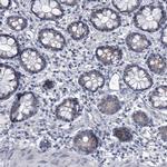 C21orf63 Antibody in Immunohistochemistry (IHC)