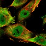 SASH1 Polyclonal Antibody