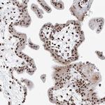 SASH1 Antibody in Immunohistochemistry (Paraffin) (IHC (P))