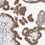 SASH1 Polyclonal Antibody