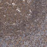 RSPO3 Polyclonal Antibody