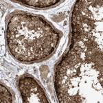 REPS1 Polyclonal Antibody