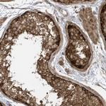 REPS1 Polyclonal Antibody