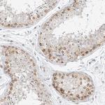 NHSL1 Antibody in Immunohistochemistry (IHC)