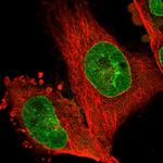 NHSL1 Polyclonal Antibody