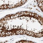 NHSL1 Polyclonal Antibody