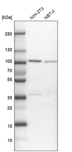 FTSJD2 Antibody in Western Blot (WB)
