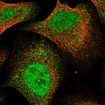 FTSJD2 Polyclonal Antibody