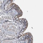 Calpain 13 Polyclonal Antibody