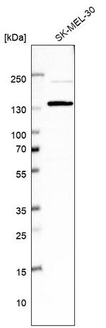 USP48 Antibody in Western Blot (WB)