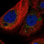SMYD4 Polyclonal Antibody