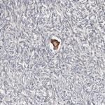 SMYD4 Antibody in Immunohistochemistry (IHC)