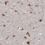 LURAP1 Antibody in Immunohistochemistry (IHC)