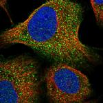 LURAP1 Antibody in Immunocytochemistry (ICC/IF)