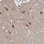 LURAP1 Antibody in Immunohistochemistry (Paraffin) (IHC (P))
