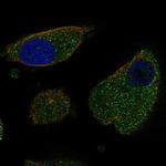 LURAP1 Polyclonal Antibody