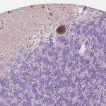 NOS1AP Antibody in Immunohistochemistry (Paraffin) (IHC (P))
