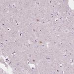 NOS1AP Antibody in Immunohistochemistry (Paraffin) (IHC (P))