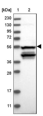 NOS1AP Antibody in Western Blot (WB)