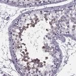 SYNGR4 Antibody in Immunohistochemistry (IHC)