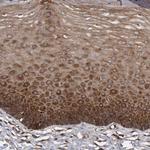 KCTD20 Antibody in Immunohistochemistry (Paraffin) (IHC (P))