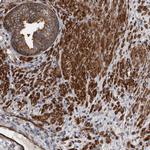 KCTD20 Antibody in Immunohistochemistry (Paraffin) (IHC (P))