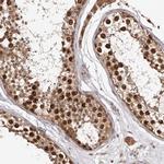RNF187 Antibody in Immunohistochemistry (Paraffin) (IHC (P))