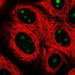 SPATA17 Polyclonal Antibody