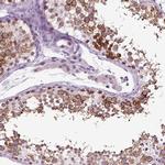 SPATA17 Antibody in Immunohistochemistry (IHC)