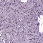 SPATA17 Antibody in Immunohistochemistry (IHC)