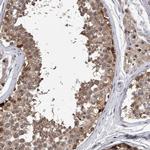 RWDD2A Polyclonal Antibody