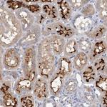 RWDD2A Polyclonal Antibody