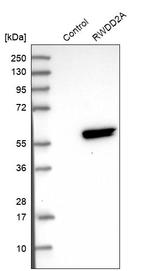 RWDD2A Antibody in Western Blot (WB)