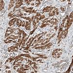 SNX26 Antibody in Immunohistochemistry (Paraffin) (IHC (P))