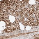 SNX26 Antibody in Immunohistochemistry (Paraffin) (IHC (P))