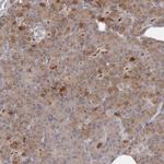 ANR44 Polyclonal Antibody